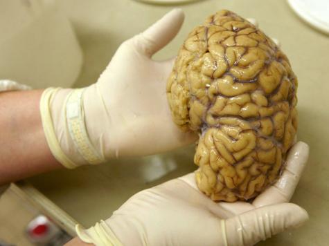 الاعداد للبحث خريطة الدماغ البشري